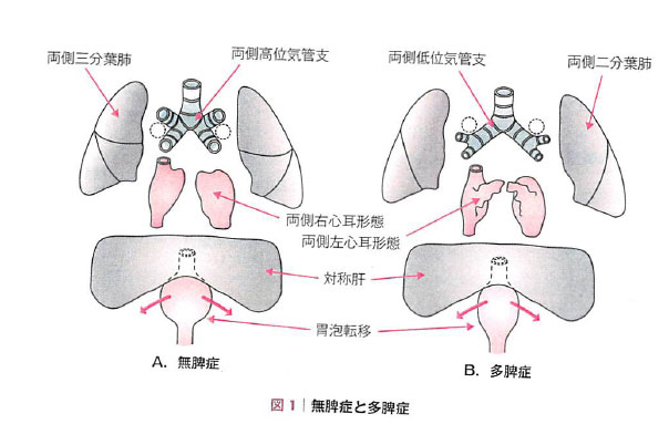 多脾