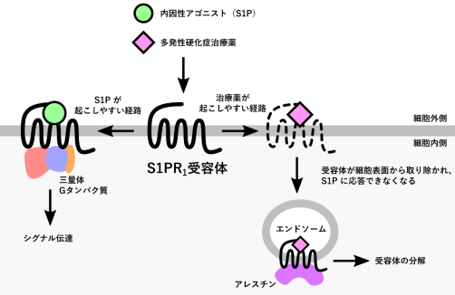 豊胸インプラントによる母乳育児