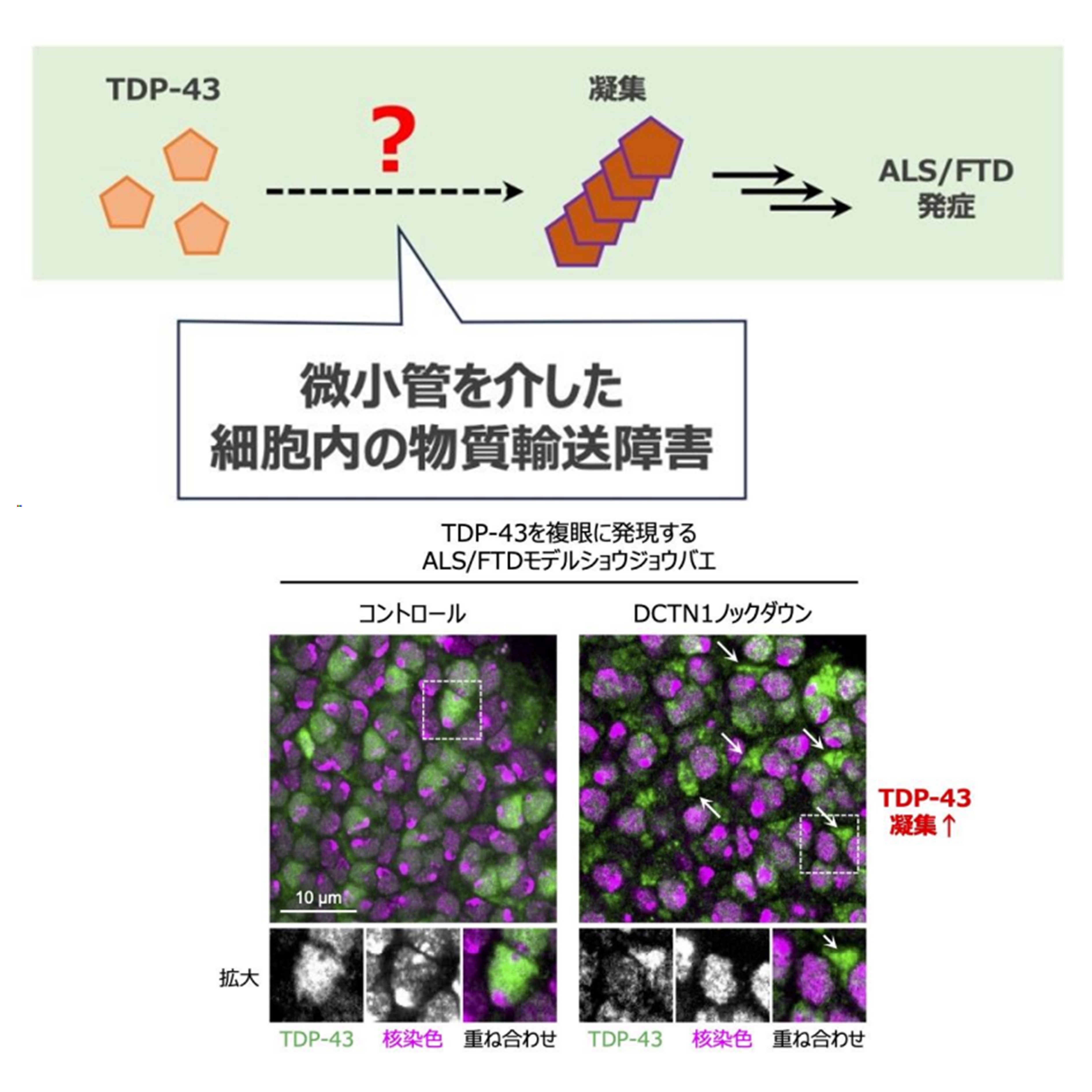 筋萎縮性側索硬化症と前頭側頭型認知症の原因となるタンパク質