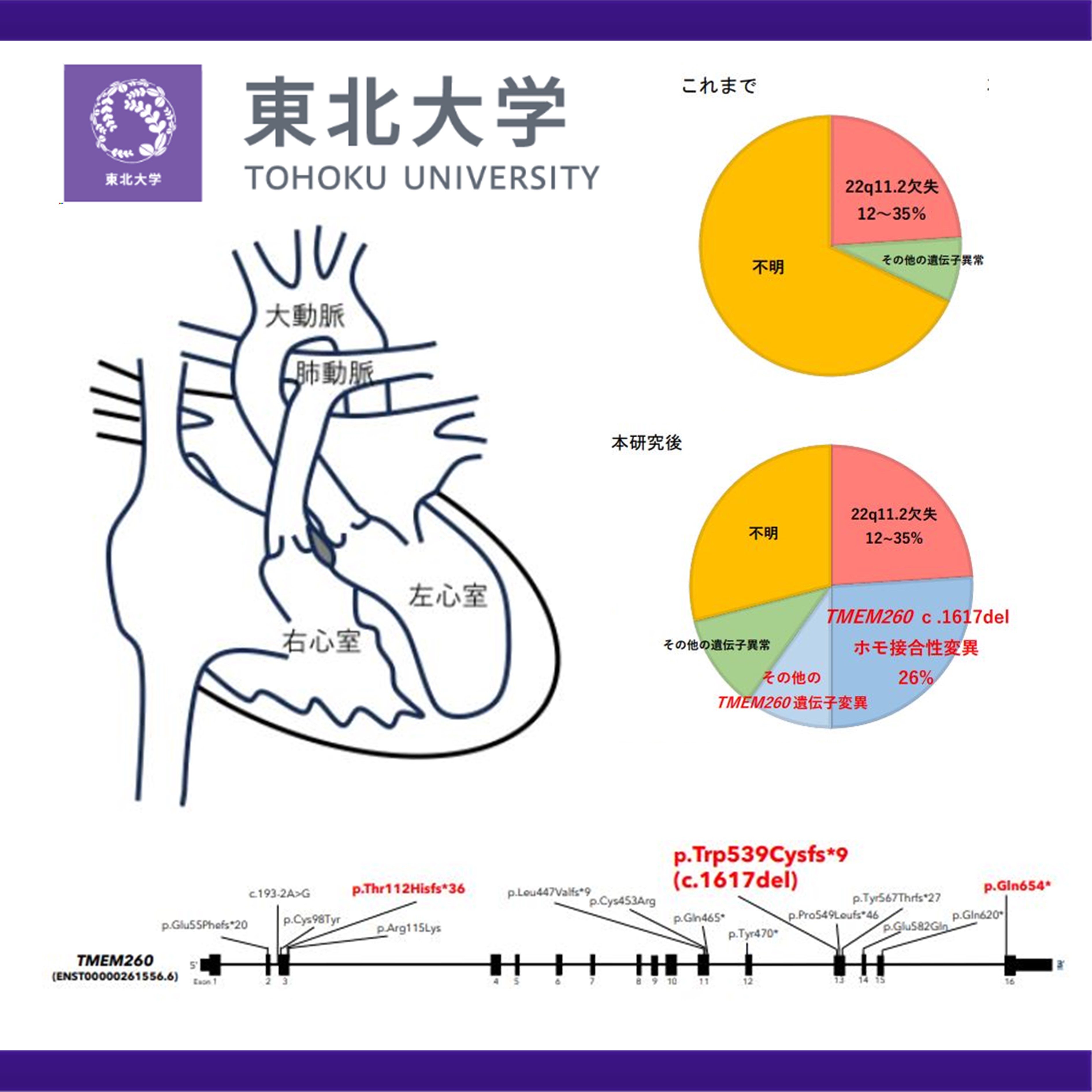 重症先天性心疾患の一つである総動脈幹症の主要な原因遺伝子を発見