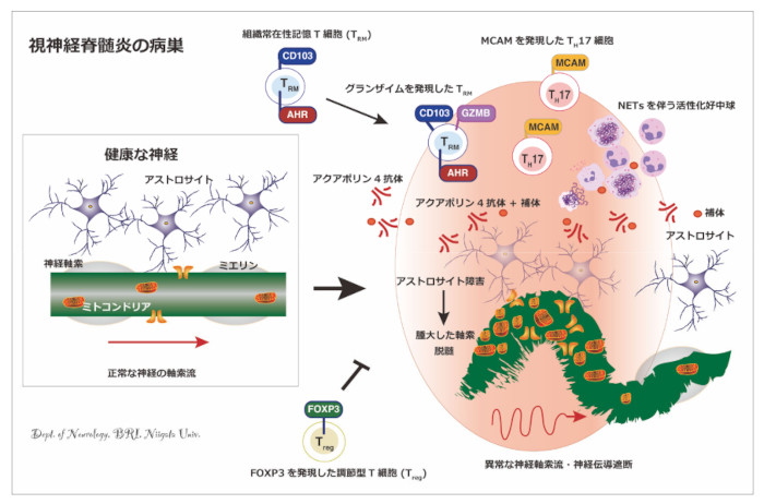 視神経脊髄炎（NMO）の炎症を正負に制御する免疫ダイナミクスを