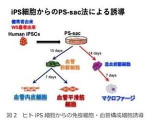 ウェルナー症候群（WS）に多い動脈硬化の発症要因を解明 RareS.(レアズ)