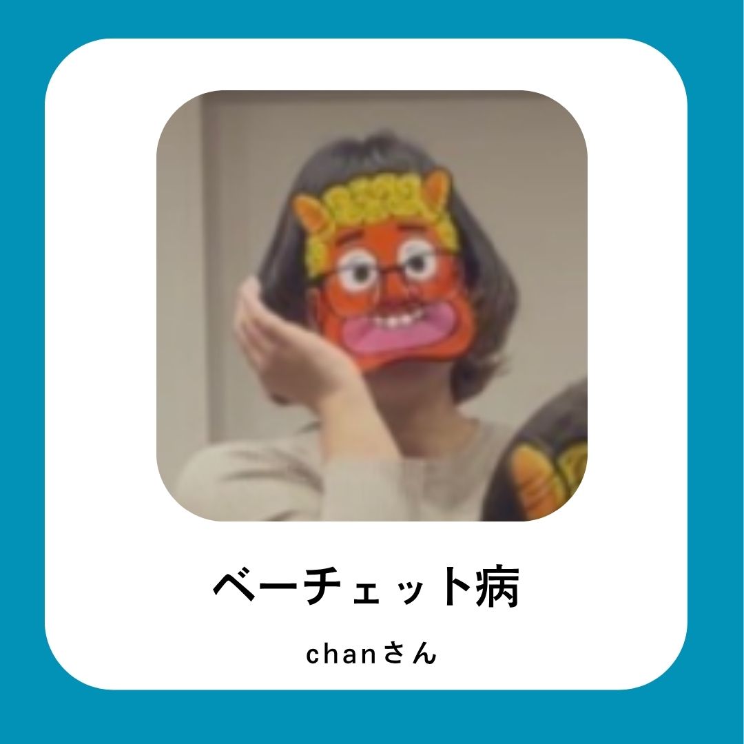 ベーチェット 病 疲れ やすい